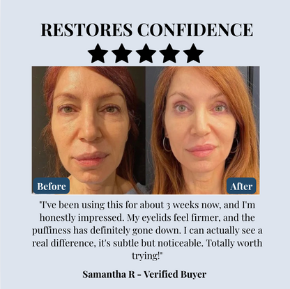 Lid Lifting Treatment